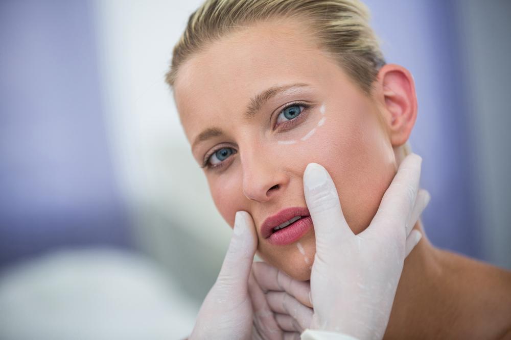 Beneficios del tratamiento de ojeras con ácido hialurónico