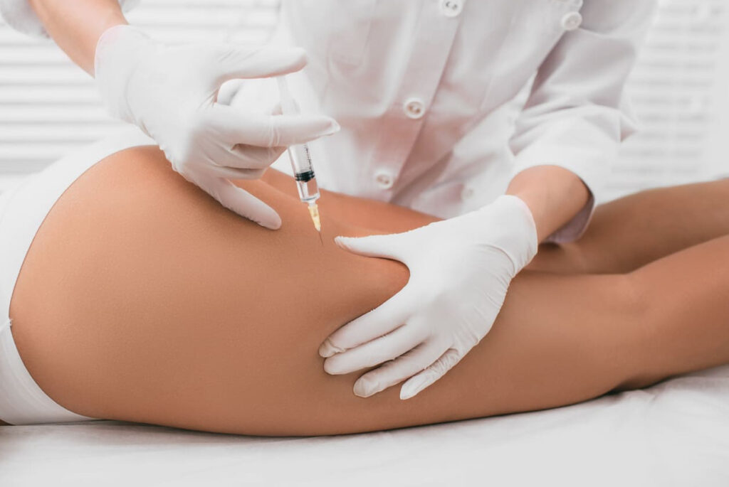 Mesoterapia