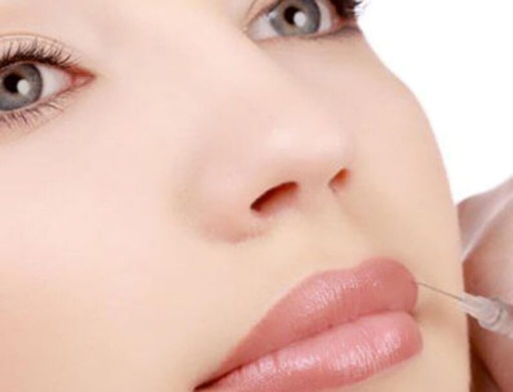 qué es la armonización facial